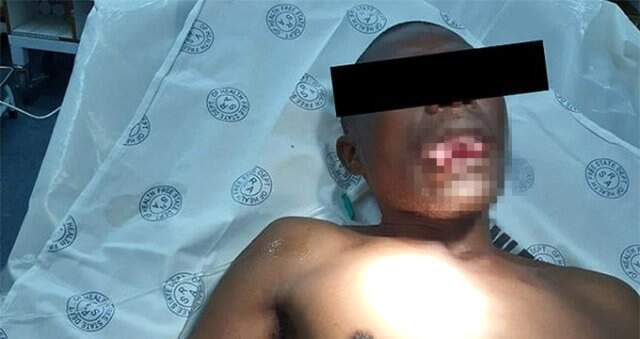 Kadın doktor tecavüzden saldırganının dilini kopararak kurtuldu