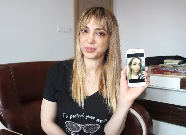 Estetik mağduru kadının yüzü tanınmaz hale geldi