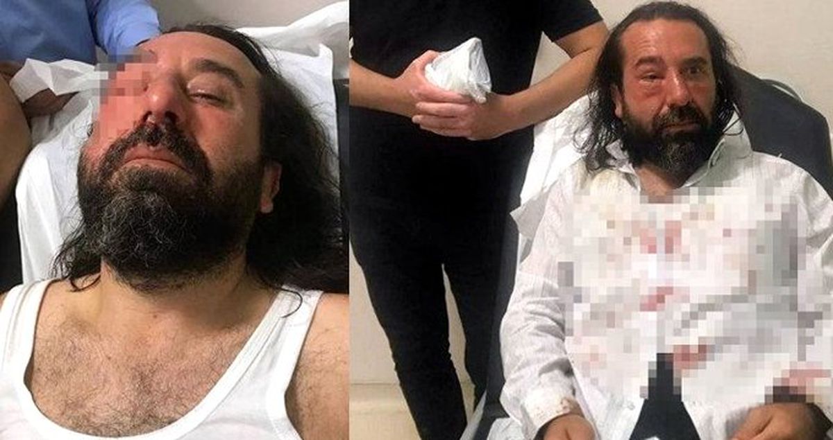 İYİ Parti kurucularından Metin Bozkurt'a saldırı