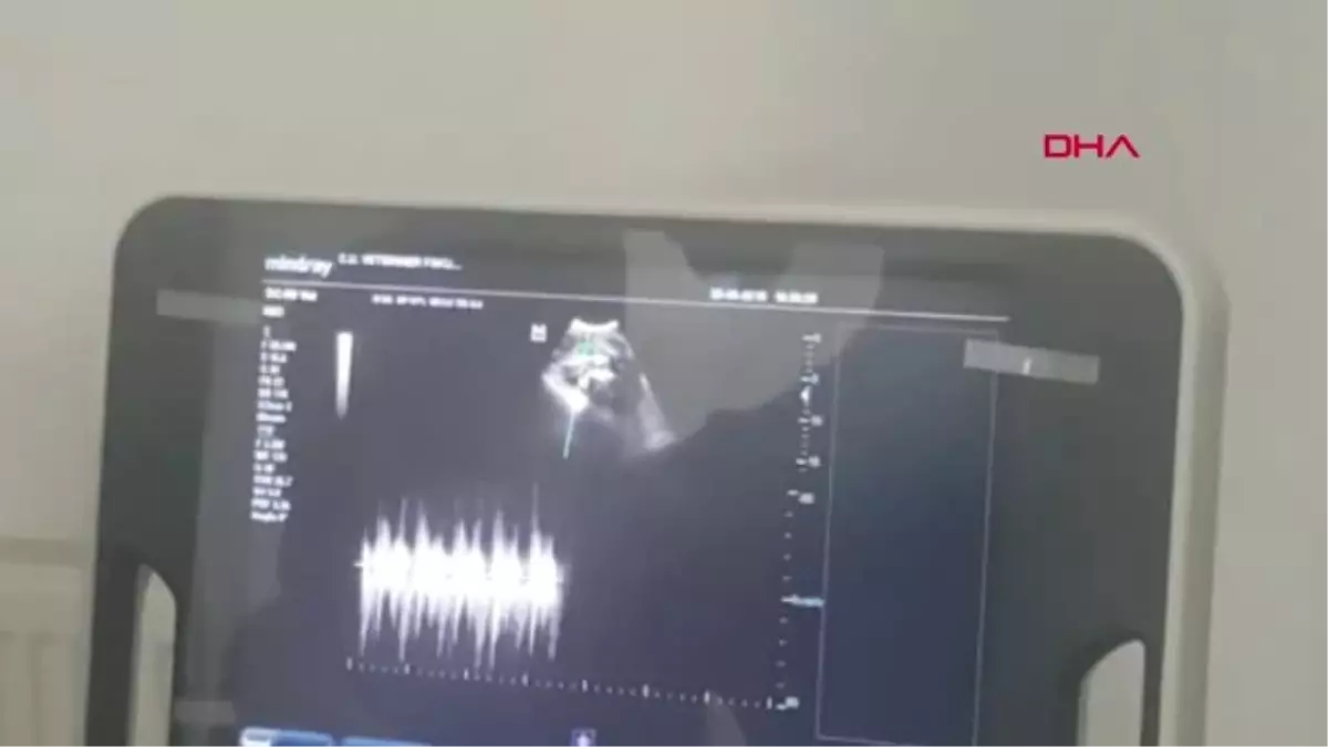 SİVAS HAMİLE KANGAL KÖPEĞİ 'HASKIZ', SEZARYENLE DOĞUM YAPTI