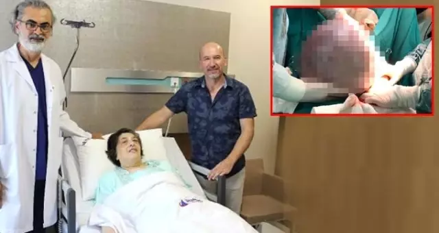 Solunum şikayetiyle doktora gitti! Karnından çıkan, doktorları bile hayrete düşürdü
