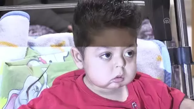 İnönü Üniversitesinin karaciğer nakliyle rekor denemesi