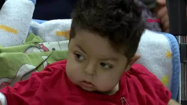 Malatya'daki eş zamanlı karaciğer naklinde hastalar taburcu olmaya başladı