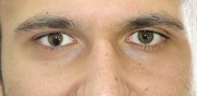 Bir gözü yeşil, diğeri kahverengi! Gören fotoğraf hemen çektiriyor