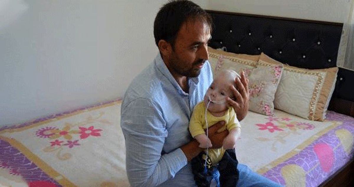 1 yaşındaki Yunus Emre'nin beyni kafatasının dışında büyüyor! Çaresiz baba yardım bekliyor