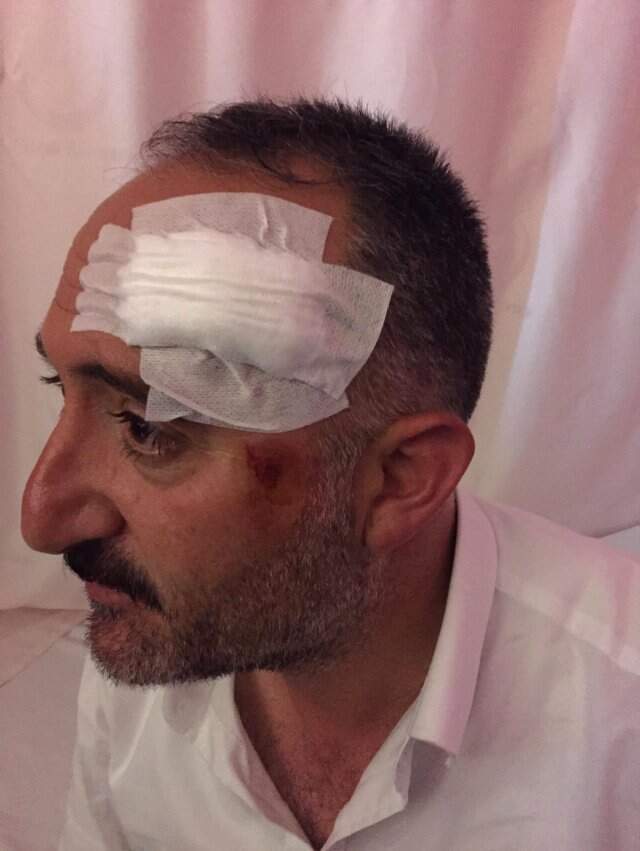 Diyadin Belediye Başkanı Demir'in polislerce darbedildiği iddiasına yalanlama