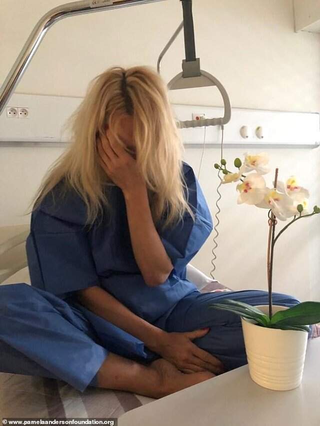 Pamela Anderson, futbolcu sevgilisi Adil Rami'nin elini çatlayana kadar ezdiğini söyledi