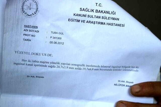 'Kız' dedikleri iki çocukları ultrasonda erkek çıktı!