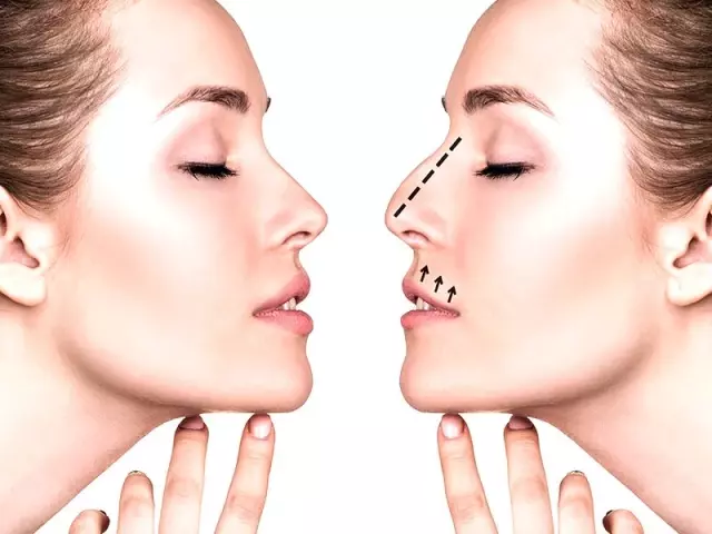 Burun Estetigi Programi Indir Nedir Faydasi Olur Mu Burun Estetigi Photoshop Yeniben Com