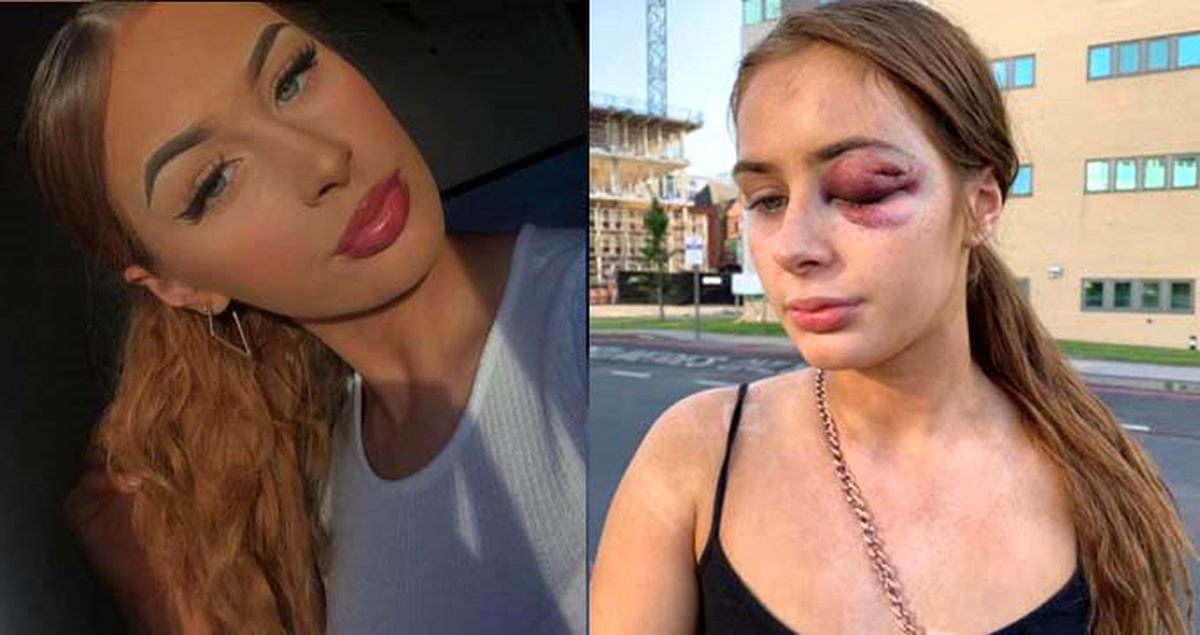 İngiltere'de bir genç kız, 'birlikte eğlenme' teklifini kabul etmediği kişi tarafından darp edildi