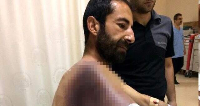 Taşla yaraladığı yılan ısırdı, hayati tehlikesi var