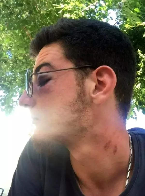 Eğlenmek için gittiği festivalde darbedildiğini iddia etti