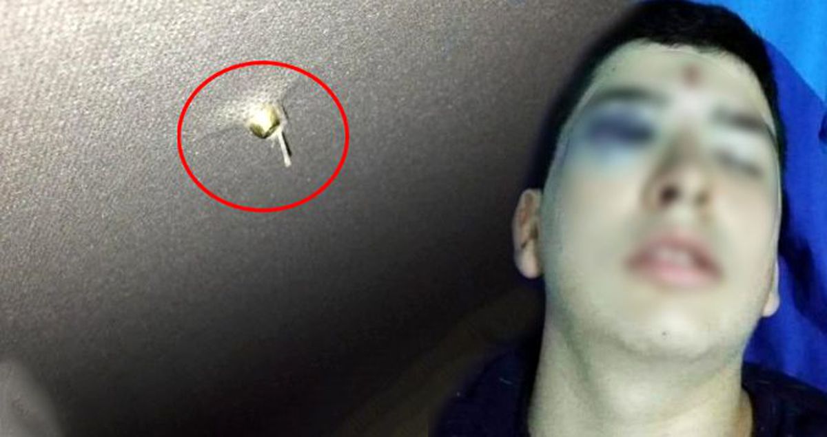 Yamaç'ı gözünden etmişlerdi! Şimdi de sürücüye dehşeti yaşattılar