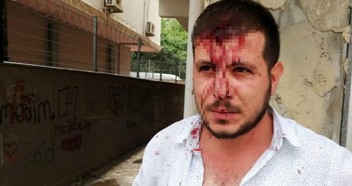 Parasını isteyen alacaklının kafasını kaldırım taşıyla yardı