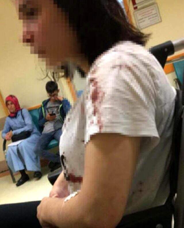 Sokak ortasında dayak yiyen genç kız konuştu: 3 yıldır peşimi bırakmadı