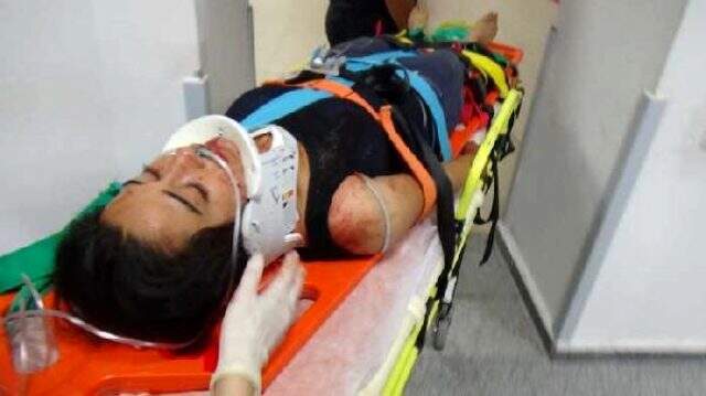 Kocası boğazından bıçakladı, kanlar içinde balkondan atlayıp yardım istedi