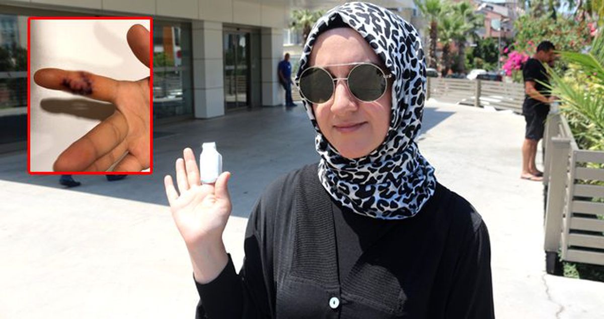 Ultra lüks otelde skandal! İhmal sonucu az daha parmağından oluyordu
