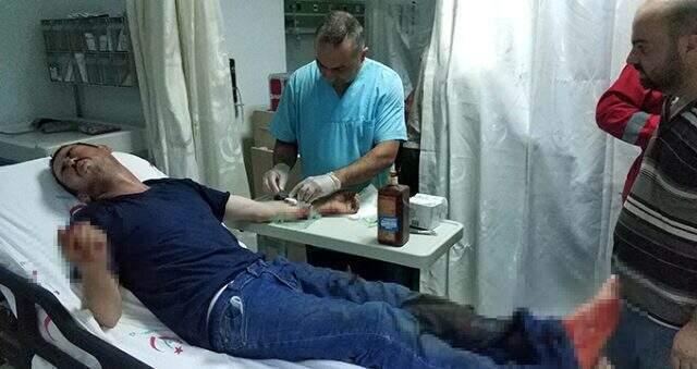 Acemi kasaplar kendilerini keserek hastanelik oldular