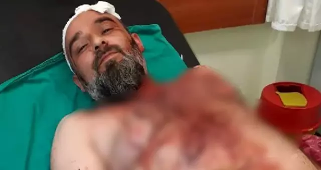 Kahramanmaraş'ta gurbetçi aileye dinlenme tesisinde saldırı: 12 yaralı, 12 gözaltı