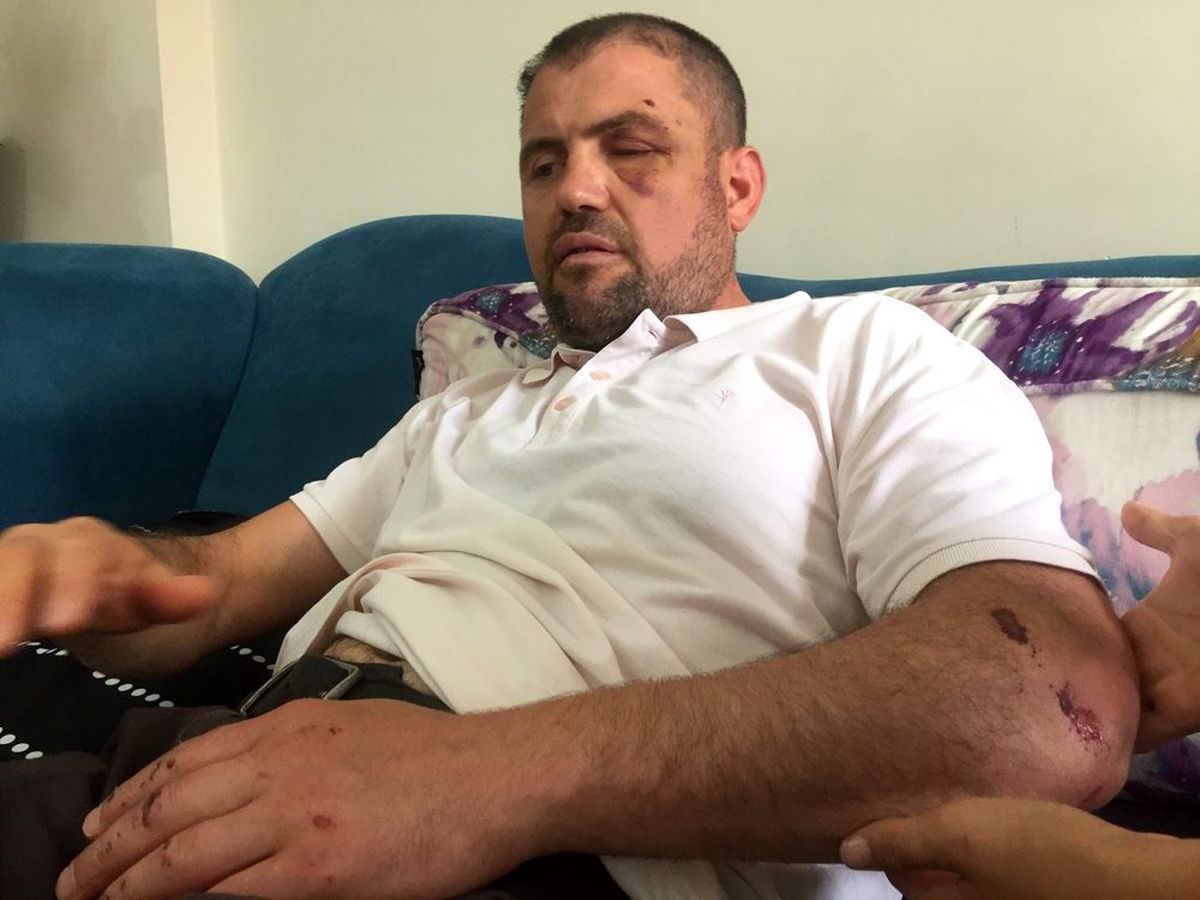 Hastanede skandal! Dört kaburgası kırılan gaziye sağlam raporu verilmiş