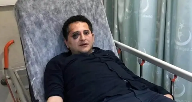İstanbul Valiliği, Erdoğan'ın korumaları ile birlikte avukat Sertuğ Sürenoğlu'nu döven polisler için kararını verdi İstanbul Valiliği, Erdoğan'ın korumaları ile birlikte avukat Sertuğ Sürenoğlu'nu döven polisler için kararını verdi