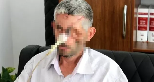 Hatay İl Sağlık Müdürlüğü: Gözünü kanserden kaybetti
