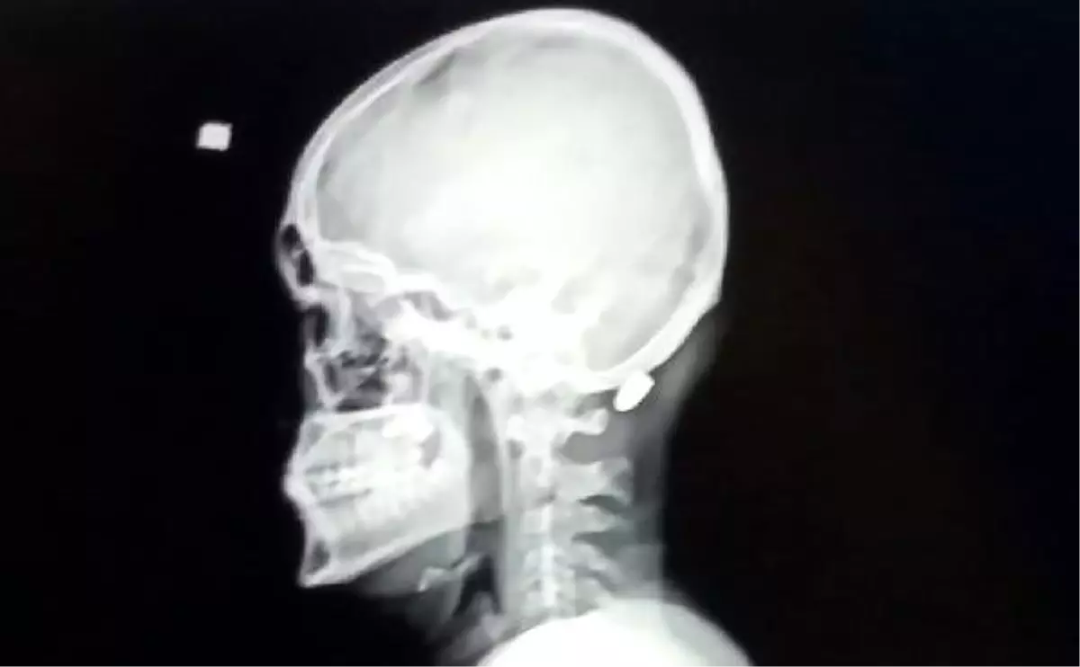 Maganda kurşunun hedefi olan genç yaralandı