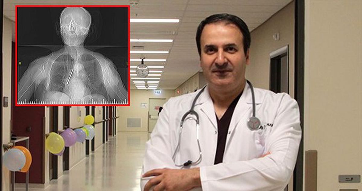 91 yaşındaki adamın akciğerinden 10 santimetrelik çivi çıktı