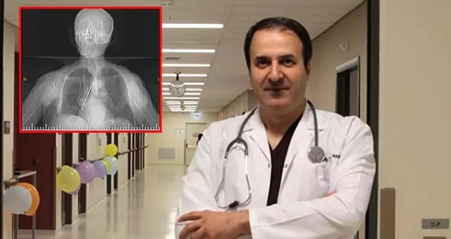 91 yaşındaki adamın akciğerinden 10 santimetrelik çivi çıktı
