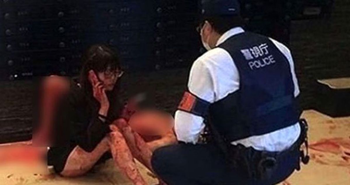 Erkek arkadaşını bıçaklayıp yanında sigara içen kız sosyal medyada viral oldu