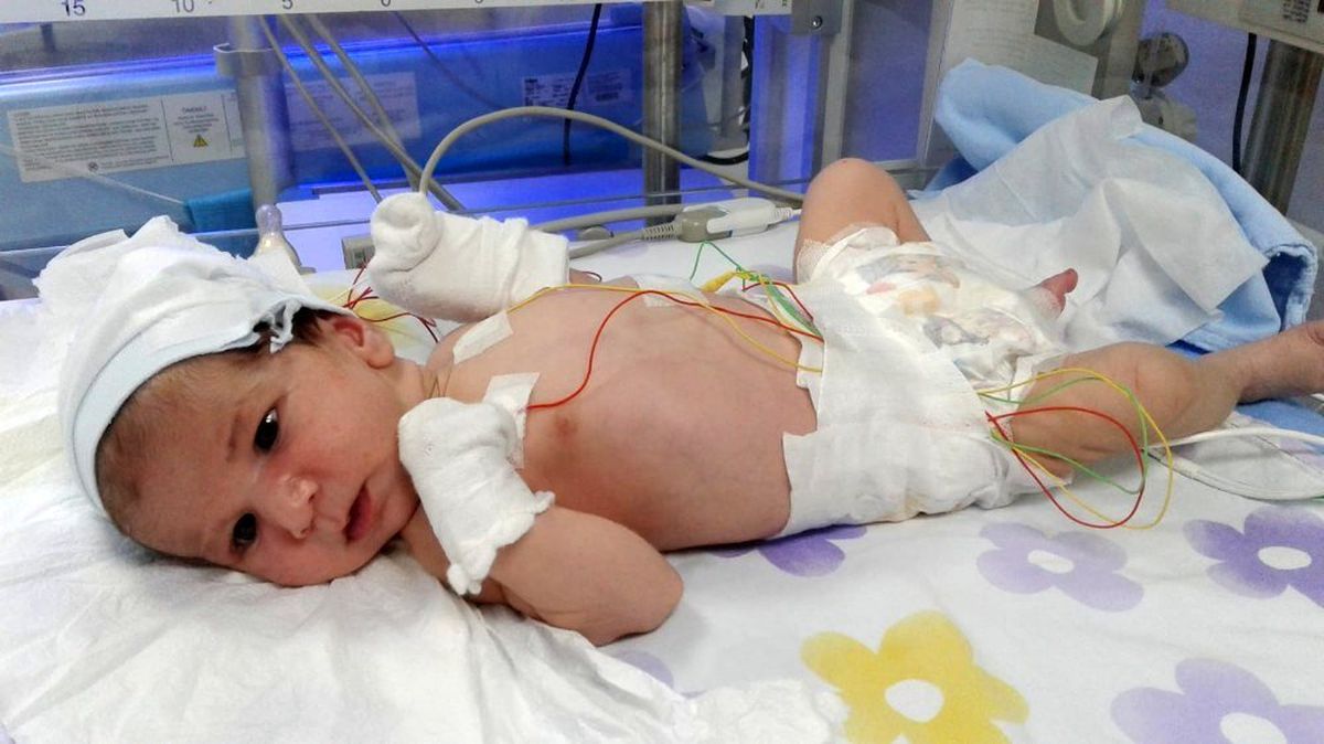 (Özel) Asel bebek için 'yaşatın' çığlığı