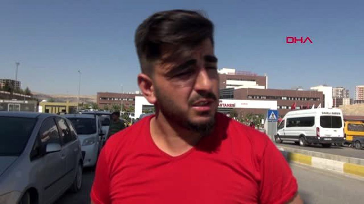 'Merdivenden düştü' deyip hastaneye getirdiği 10 çocuk annesi karısını, öldüresiye dövdüğü ortaya çıktı