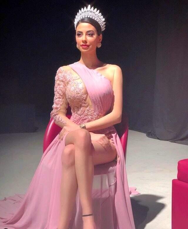 Yasak Elma'ya Best Model of the World birincisi Iman Casablanca transfer oldu