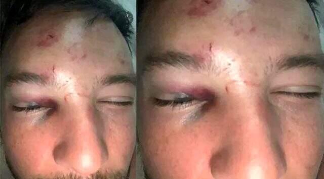 Gece kulübünde 6 kişi tarafından dayak yiyen Drinkwater, 6 hafta forma giyemeyecek