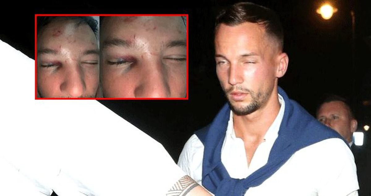 Gece kulübünde 6 kişi tarafından dayak yiyen Drinkwater, 6 hafta forma giyemeyecek