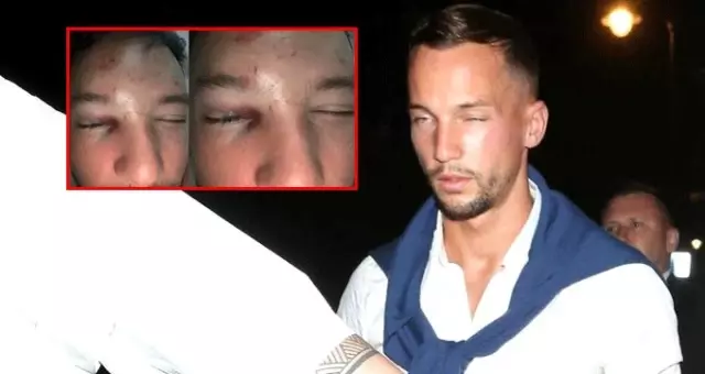 Gece kulübünde 6 kişi tarafından dayak yiyen Drinkwater, 6 hafta forma giyemeyecek