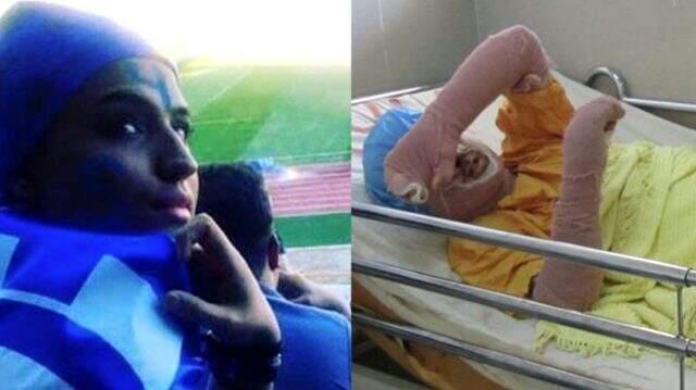 Futbol maçına gittiği için yargılanan genç kadın, kendini yakarak hayatına son verdi