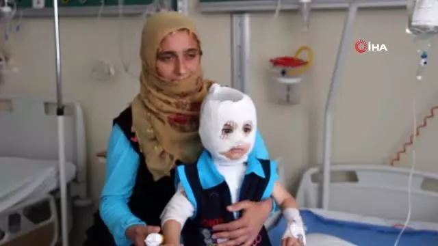 Isıtıcıdaki kaynar su üzerine döküldü, küçük çocuk ölümden döndü Isıtıcıdaki kaynar su üzerine döküldü, küçük çocuk ölümden döndü
