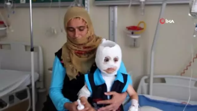 Isıtıcıdaki kaynar su üzerine döküldü, küçük çocuk ölümden döndü Isıtıcıdaki kaynar su üzerine döküldü, küçük çocuk ölümden döndü