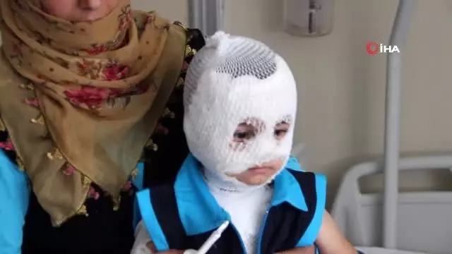 Isıtıcıdaki kaynar su üzerine döküldü, küçük çocuk ölümden döndü Isıtıcıdaki kaynar su üzerine döküldü, küçük çocuk ölümden döndü