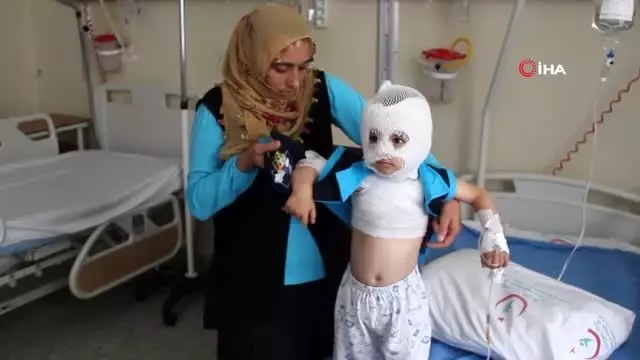 Isıtıcıdaki kaynar su üzerine döküldü, küçük çocuk ölümden döndü Isıtıcıdaki kaynar su üzerine döküldü, küçük çocuk ölümden döndü