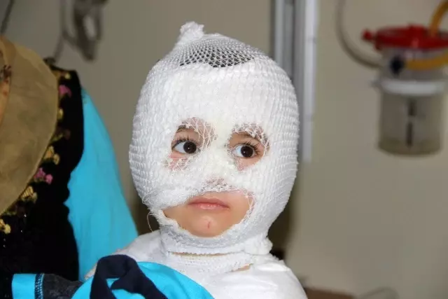 Isıtıcıdaki kaynar su üzerine dökülen çocuk ölümden döndü Isıtıcıdaki kaynar su üzerine dökülen çocuk ölümden döndü