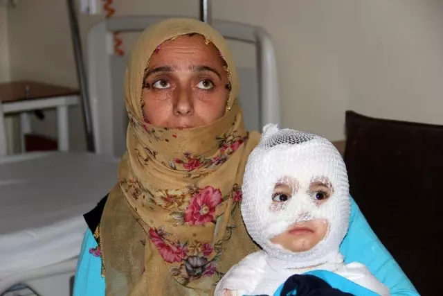 Isıtıcıdaki kaynar su üzerine dökülen çocuk ölümden döndü Isıtıcıdaki kaynar su üzerine dökülen çocuk ölümden döndü