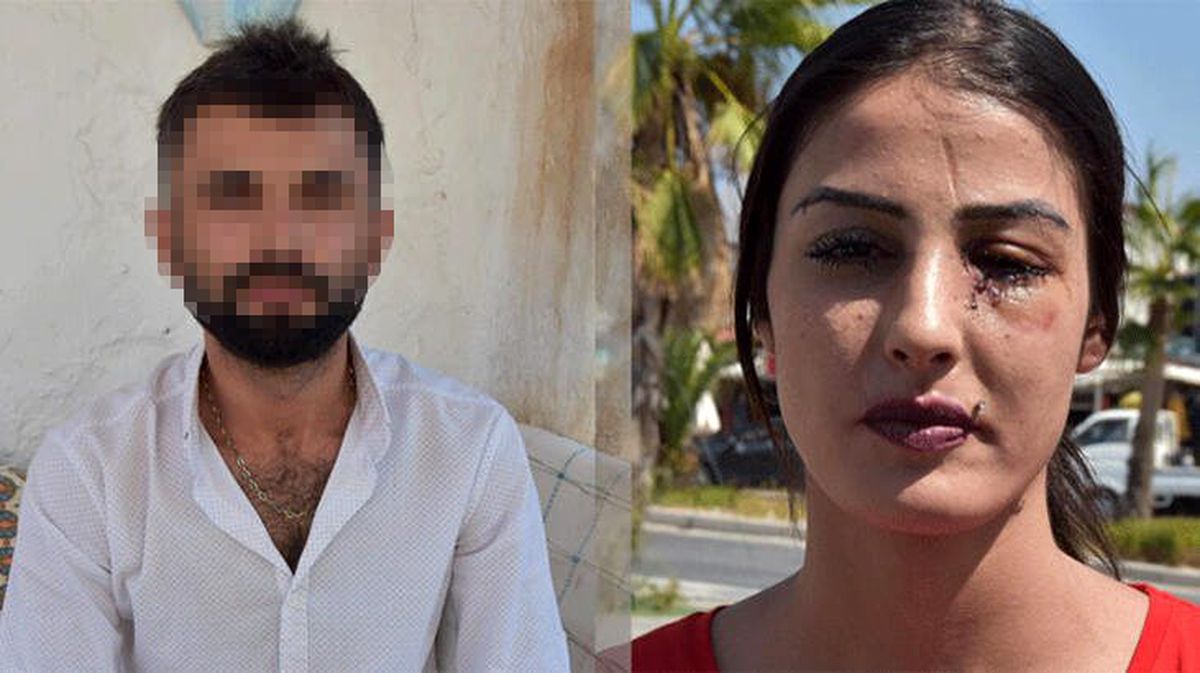 Eski eşi tarafından yüzü şişeyle parçalanan kadın yardım istedi: Bu adam beni öldürecek
