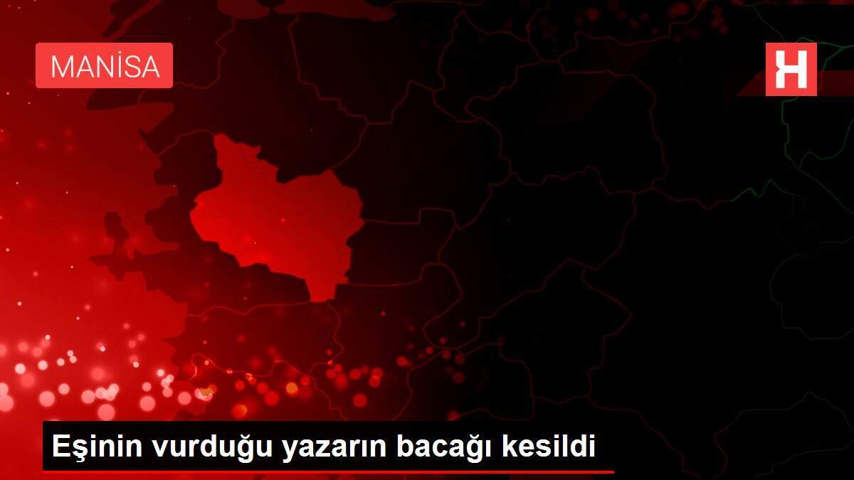 Eşinin vurduğu yazarın bacağı kesildi