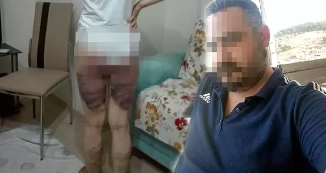 İçler acısı görüntü! Karısını bacakları çürüyene kadar döven koca 8 yıl hapis aldı