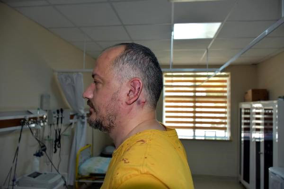 Gezgin fatih koparan'a dükkanının önünde sopalı saldırı