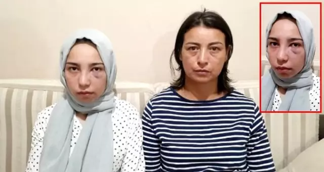 17 yaşındaki kızı köpek havlıyor diye acımasızca darp ettiler