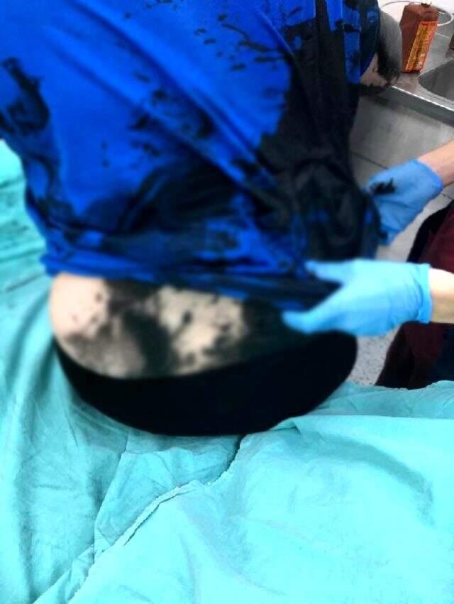 Adana'da iki kişi bir kadını darp edip, üzerine siyah renkli yanıcı madde döktü