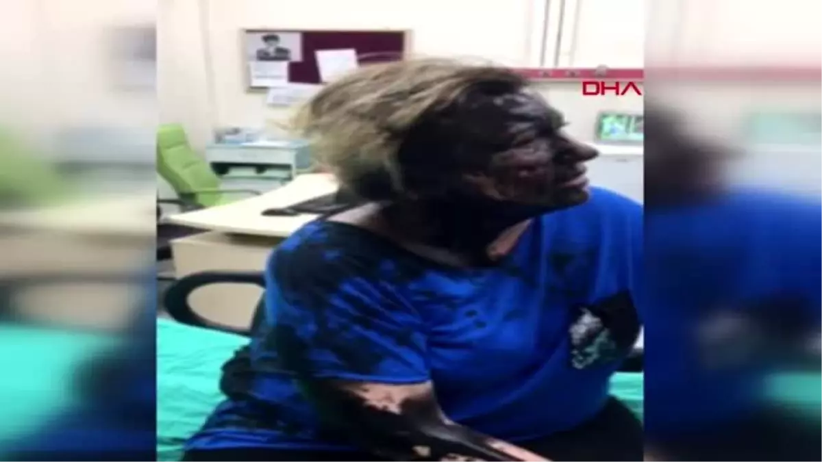 Adana genç kadını darp edip, üzerine siyah renkli sıvı madde döktüler